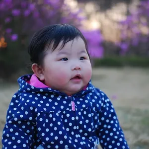 A severe case of baby eczema on face 300x300 Eczema in babies   how to care?